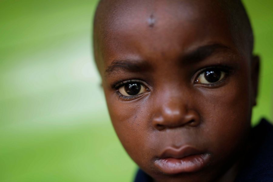 Foto: Jerome Delay/AP Photo/TT | Sexårige Alpha Melek skadades i en rebellattack i Beni, Kongo-Kinshasa.