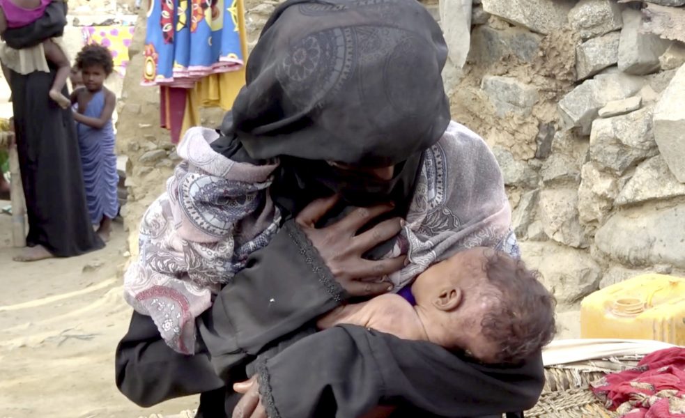 Hammadi Issa/AP/TT | Det svårt undernärda spädbarnet Zahara ammas av sin mamma i staden Aslam i Jemen i augusti 2018.