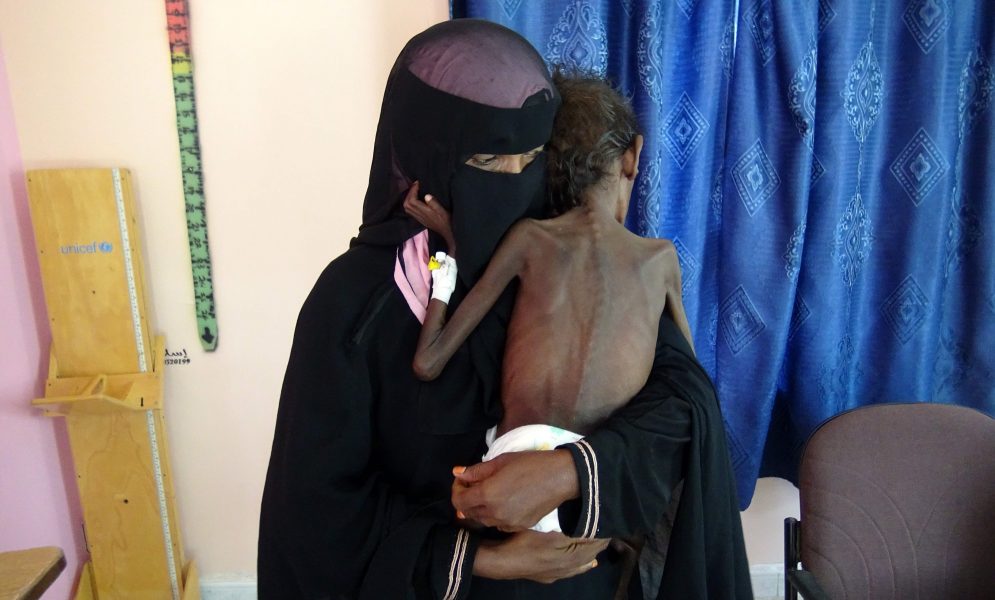 AFP/TT| En kvinna håller sin femåriga son på ett sjukhus i hamnstaden al-Hudaydah i västra Jemen.