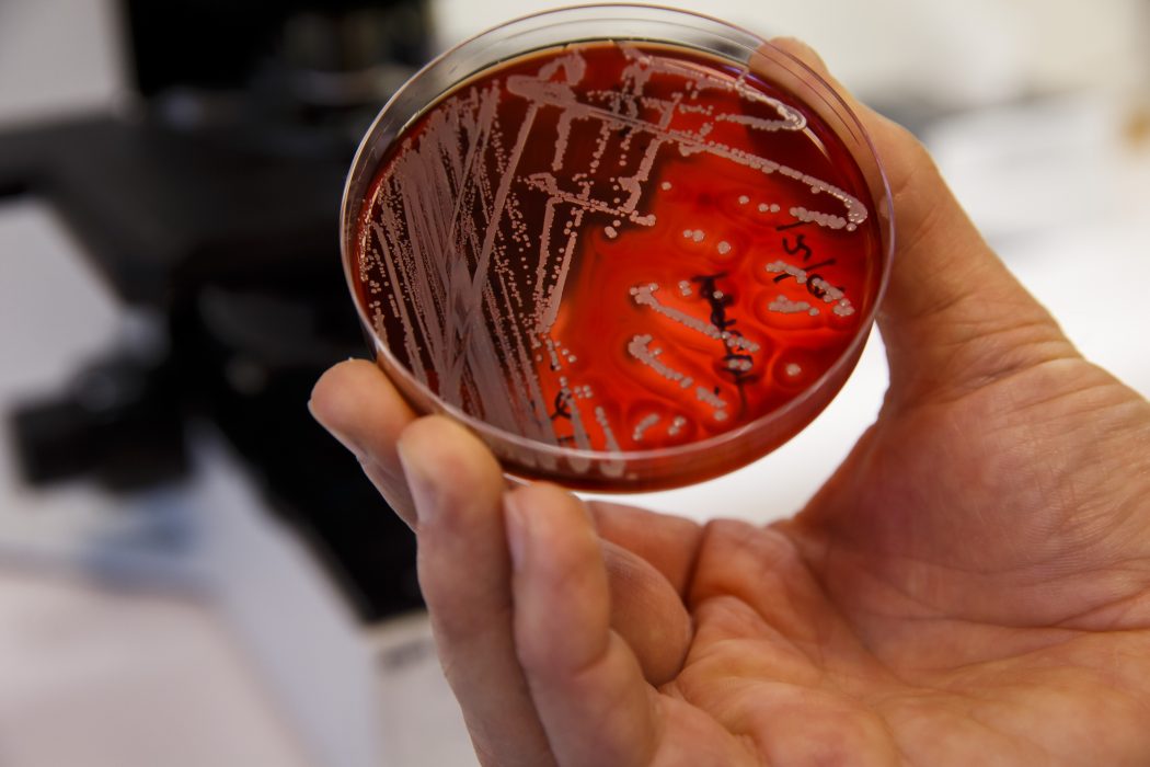 Cornelius Poppe/TT | 33 000 européer får varje år sätta livet till på grund av antibiotikaresistens.