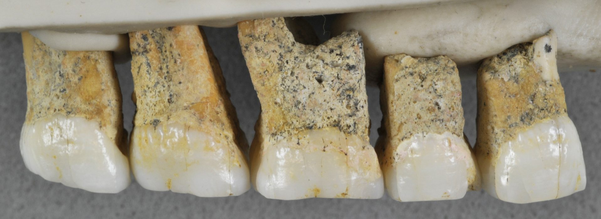 Övertänder från individen CCH6 av den nyupptäckta människoarten Homo luzonensis i Filippinerna.