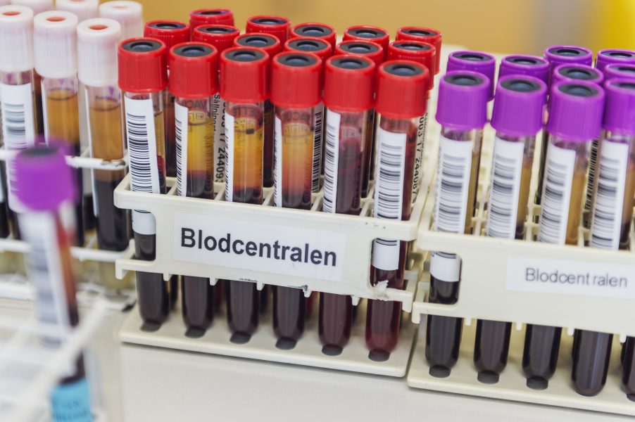 Göteborgare uppmanas att fylla på bloddepåerna.