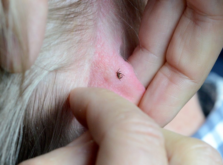 Fästingfynd i Norrbottens, Västerbottens och Jämtlands län är av särskilt intresse för Statens veterinärmedicinska anstalt som ber allmänheten om insamlingshjälp.