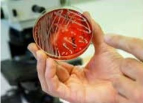 Forskare i Göteborg har gjort ny upptäckt om multiresistenta bakterier.