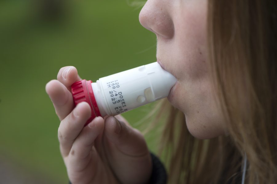 Ny svensk forskning har identifierat 141 gener som kan kopplas till utveckling av astma, hösnuva och eksem.