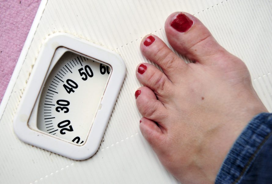 Ätstörningspatienter som väger mer får vänta längre på vård.