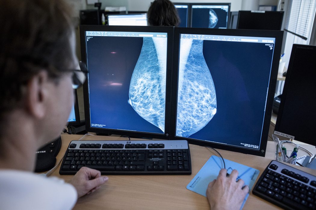 Meningarna går isär om riskerna med hormonbehandling av klimakteriebesvär.