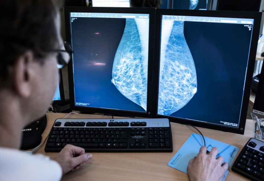 I stället för att låta en läkare titta på röntgenbilder av bröst, kan konstgjord intelligens göra samma sak fast både snabbare och bättre.