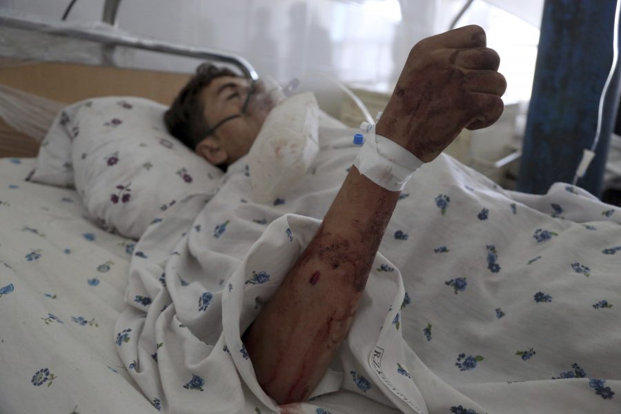 En pojke vårdas för sina skador efter en självmordsattack i Parwanprovinsen i Afghanistan i mitten av september i år.