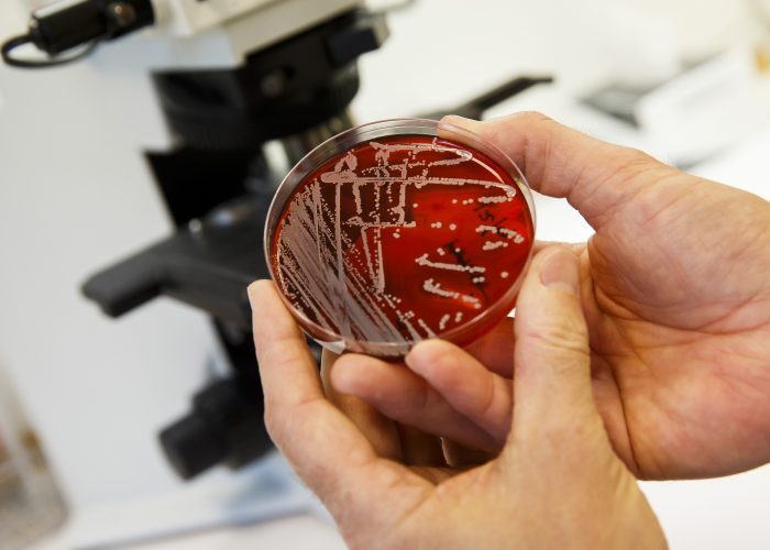 ANTIBIOTIKARESISTENTA BAKTERIER