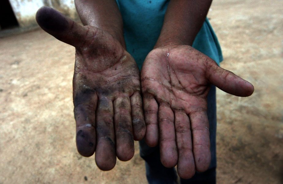 En jordbruksarbetare i nordöstra Brasilien visar sina skadade händer.