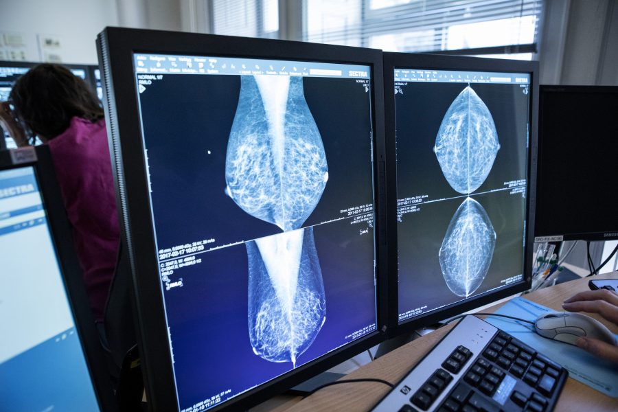En ny studie från Karolinska Institutet tyder på att AI-algoritmer är lika träffsäkra som en genomsnittlig röntgenläkare på att hitta misstänkt bröstcancer.