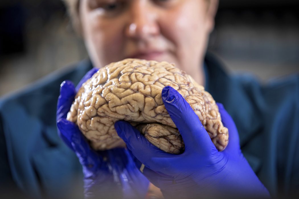 Hos personer med Alzheimers och Parkinsons sjukdomar dör vissa av hjärncellerna i takt med sjukdomsförloppet.
