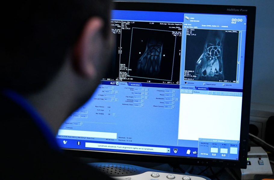 Metoden att granska röntgenbilder för att bedöma så kallad skelettmognad är omtvistad och ska nu granskas närmare.