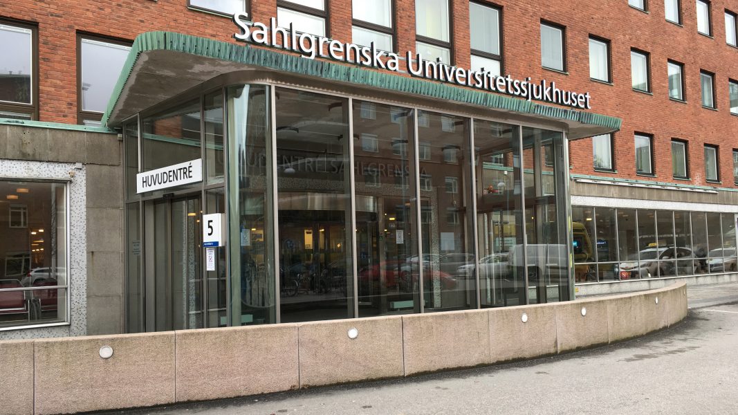 Sveriges första transplantation av lungor till en covid 19-patient har gjorts på Sahlgrenska universitetssjukhuset i Göteborg.