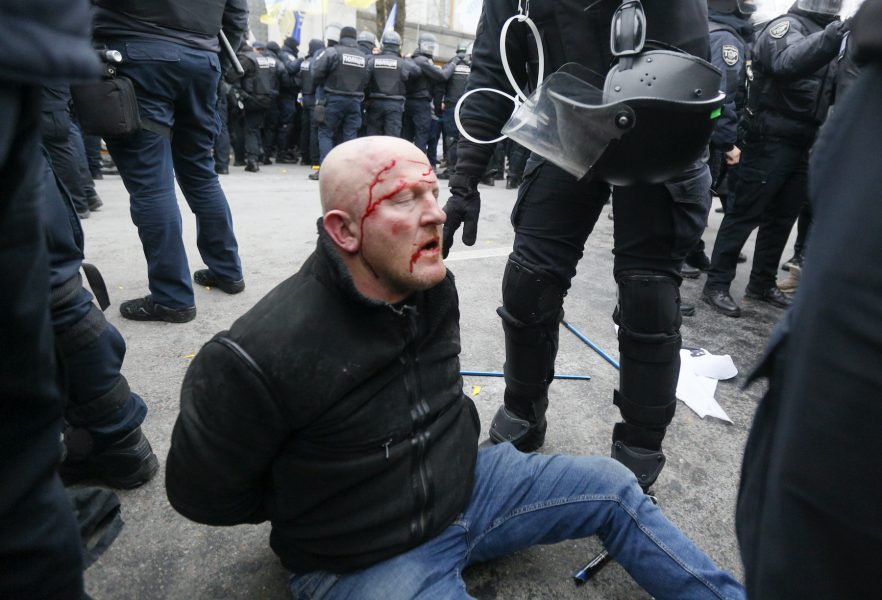 En man som skadats av polis i samband med protester mot utegångsförbud i samband med covid-19, i ukrainska Kiev.