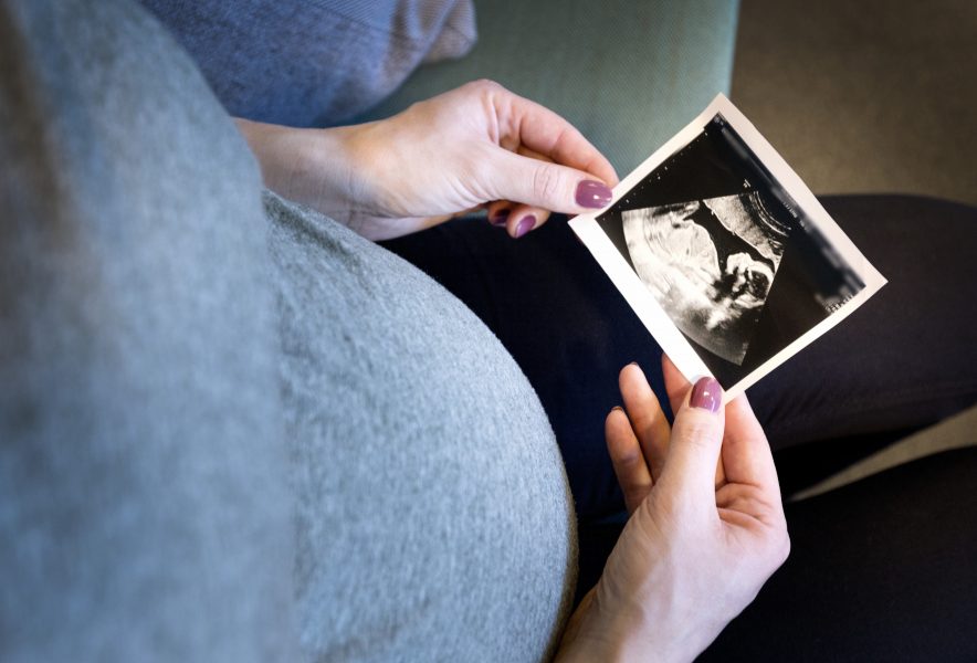Italienska forskare har hittat mikroplaster i moderkakan från gravida kvinnor.