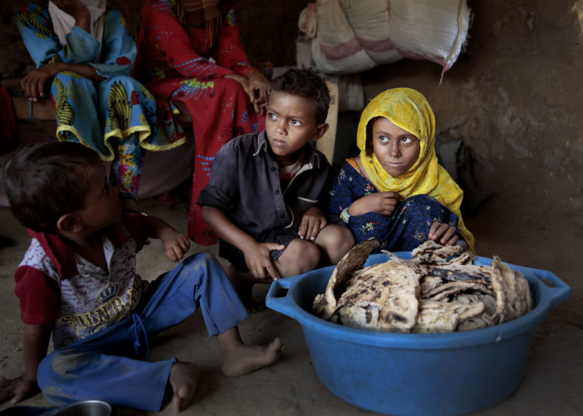 Läkare utan gränser påpekar att svält förekom i Jemen redan innan kriget började.