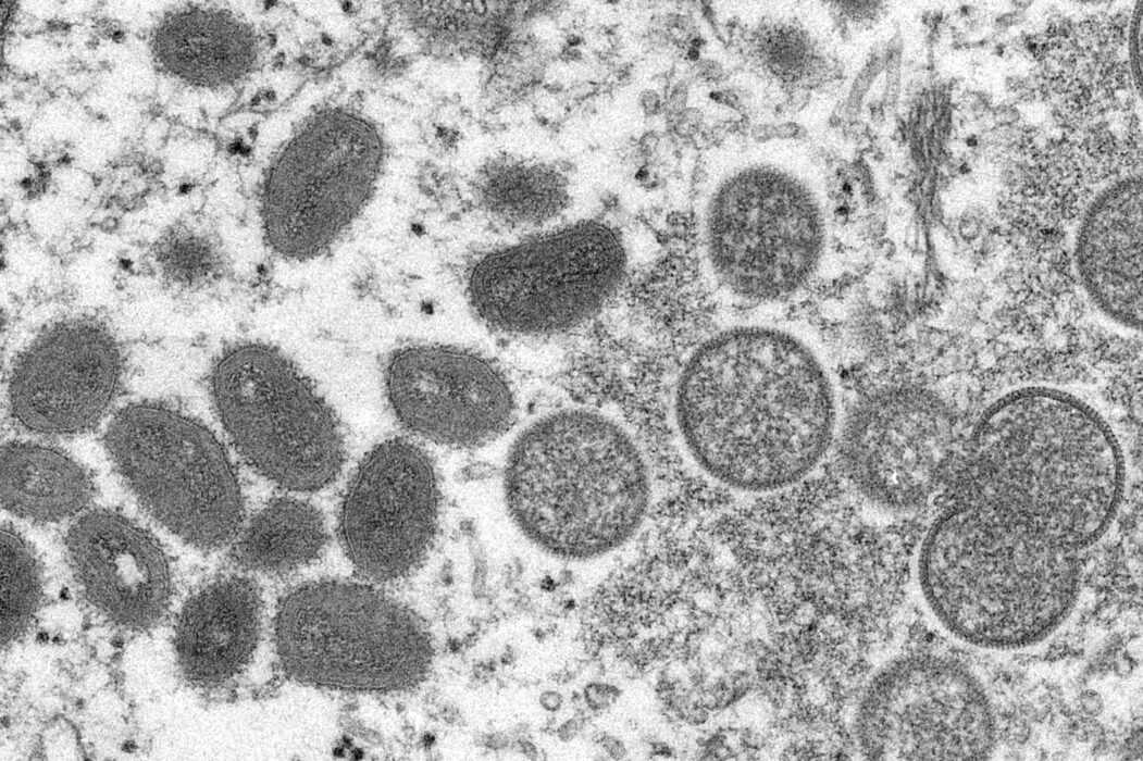 Apkoppvirus sett i elektronmikroskop.