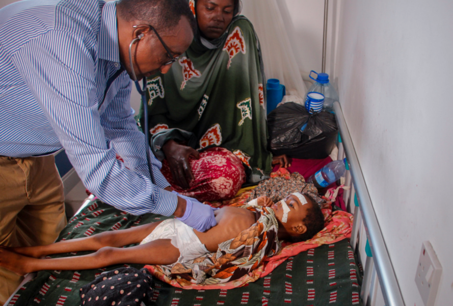 Ett undernärt barn som undersöktes på ett sjukhus i Somalias huvudstad Mogadishu i lördags.