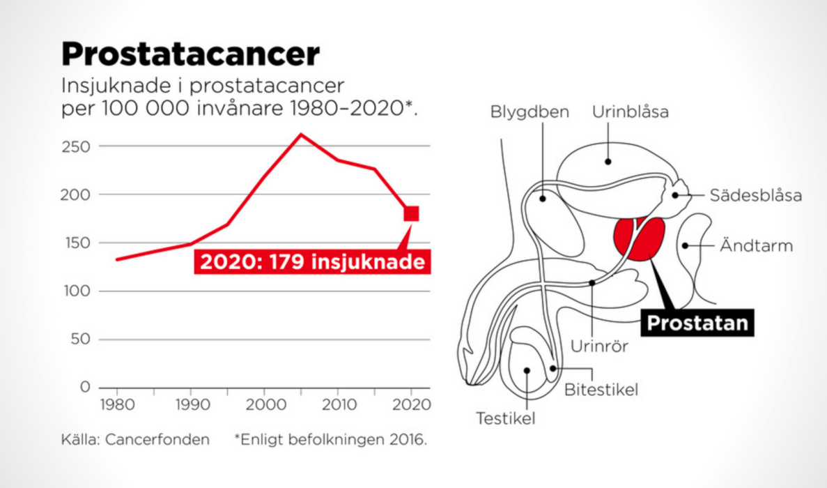 Nya Prostatatester öppnar För Allmän Screening 