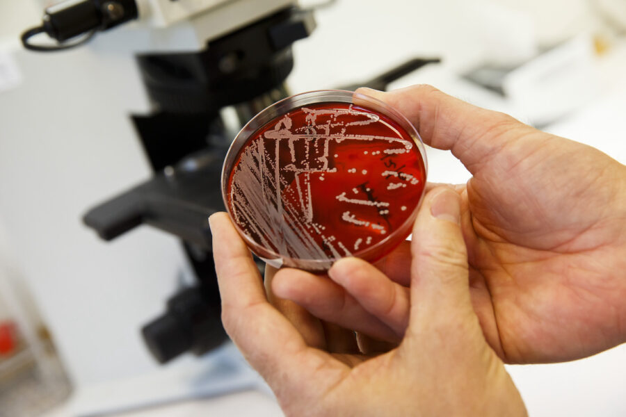Antibiotikaresistenta bakterier i ett laboratorium.