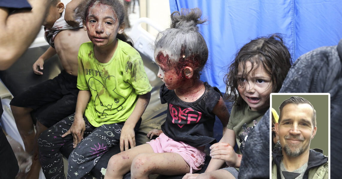 Skadade barn väntar på att bli undersökta och omplåstrade på Shifasjukhuset i Gaza i oktober 2023.