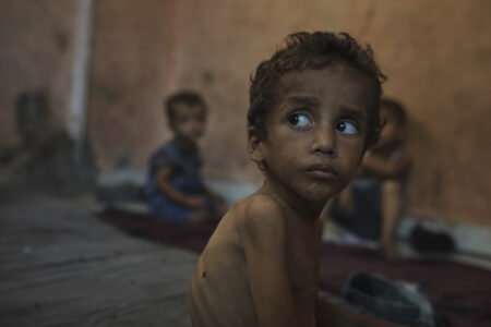 svältande flyktingbarn