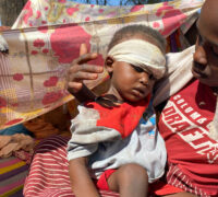 litet barn med bandage på huvudet