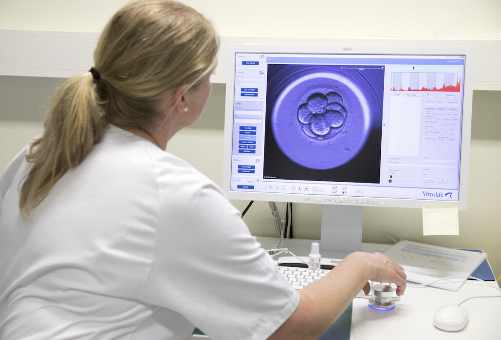 Ägg undersöks med ett embryoskop.