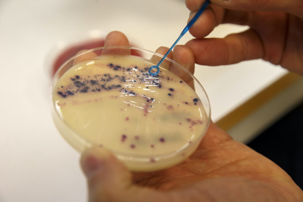 Antibiotikaresistenta bakterier i ett laboratorium i Oslo.